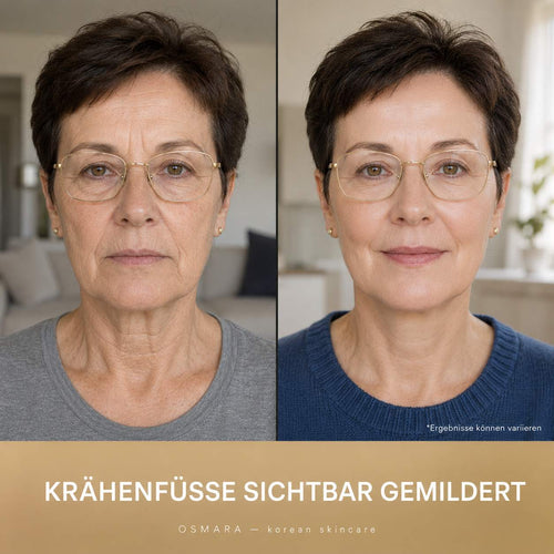 Osmara– Koreanisches Serum mit sofortigem Lifting-Effekt ab der ersten Anwendung