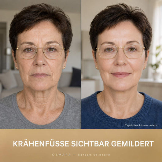 Osmara– Koreanisches Serum mit sofortigem Lifting-Effekt ab der ersten Anwendung