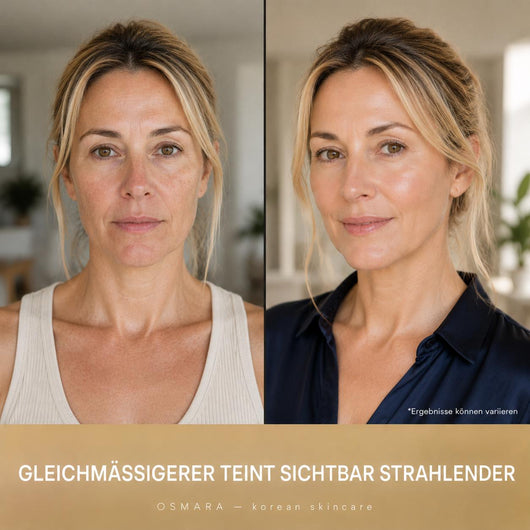 Osmara– Koreanisches Serum mit sofortigem Lifting-Effekt ab der ersten Anwendung