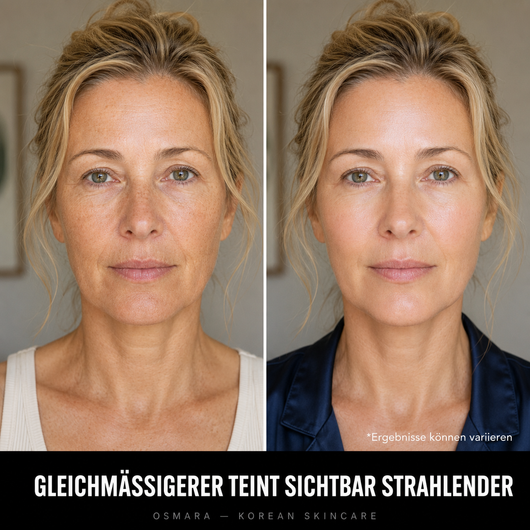 Osmara– Koreanisches Serum mit Lifting-Effekt schon ab der ersten Anwendung