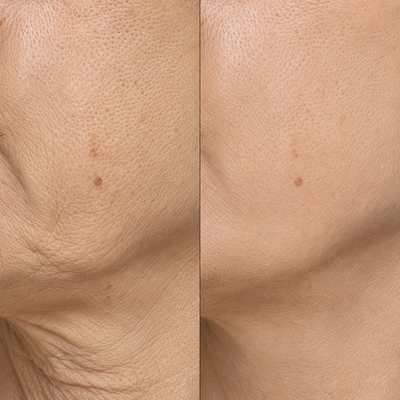 Osmara– Koreanisches Serum mit Lifting-Effekt schon ab der ersten Anwendung