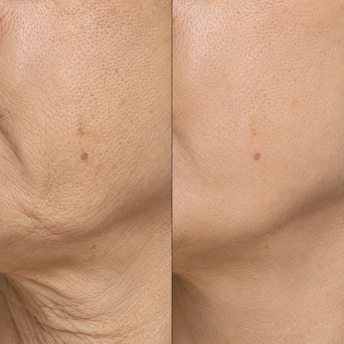 Osmara– Koreanisches Serum mit Lifting-Effekt schon ab der ersten Anwendung