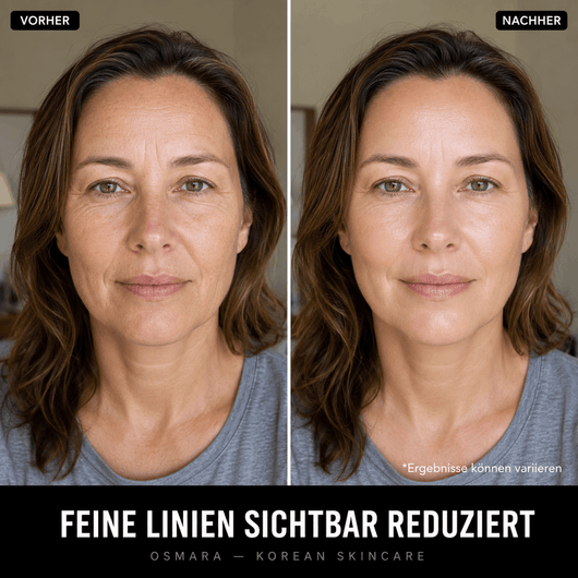 Osmara– Koreanisches Serum mit Lifting-Effekt schon ab der ersten Anwendung