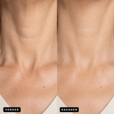 Osmara– Koreanisches Serum mit Lifting-Effekt schon ab der ersten Anwendung
