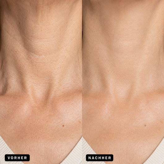 Osmara– Koreanisches Serum mit Lifting-Effekt schon ab der ersten Anwendung